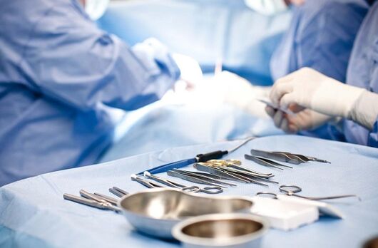 Chirurginė intervencija į lėtinį prostatitą
